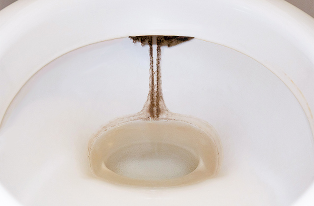 トイレの黒ずみとは？よくある発生場所